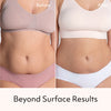 Slimdown Gel